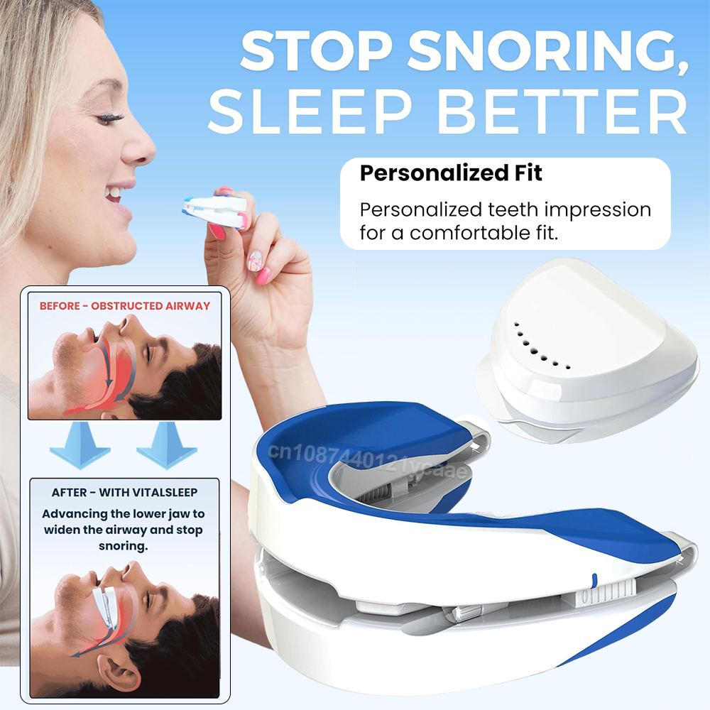 Teeth Whitening Mouth Guard - Bocchino antirussamento Dispositivo antirussamento Periodo per