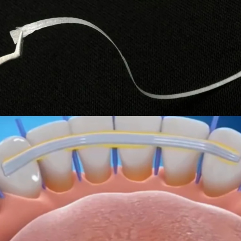1/5 Pezzi Strisce in Fibra Fle - Teeth Whitening Strips Lumineux recensione e prezzo