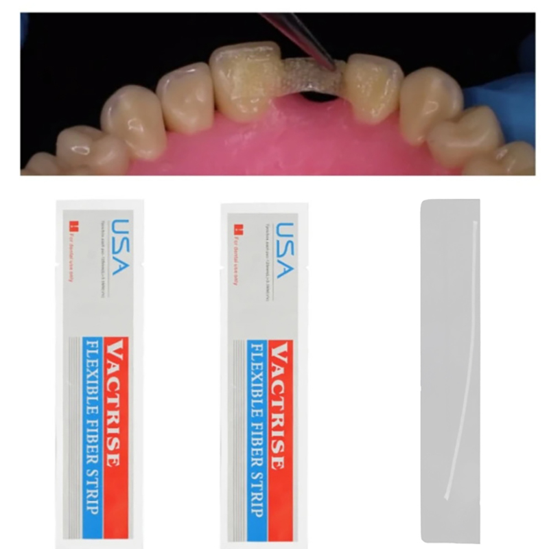 1/5 Pezzi Strisce in Fibra Fle - Teeth Whitening Strips Lumineux recensione e prezzo