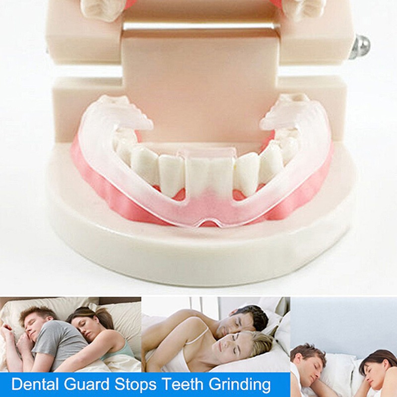 Paradenti in silicone anti-gri - Teeth Whitening Mouth Guard recensione e prezzo