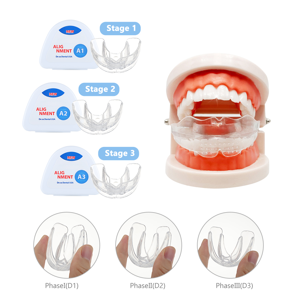 Set di apparecchi ortodontici  - Teeth Whitening Mouth Guard recensione e prezzo
