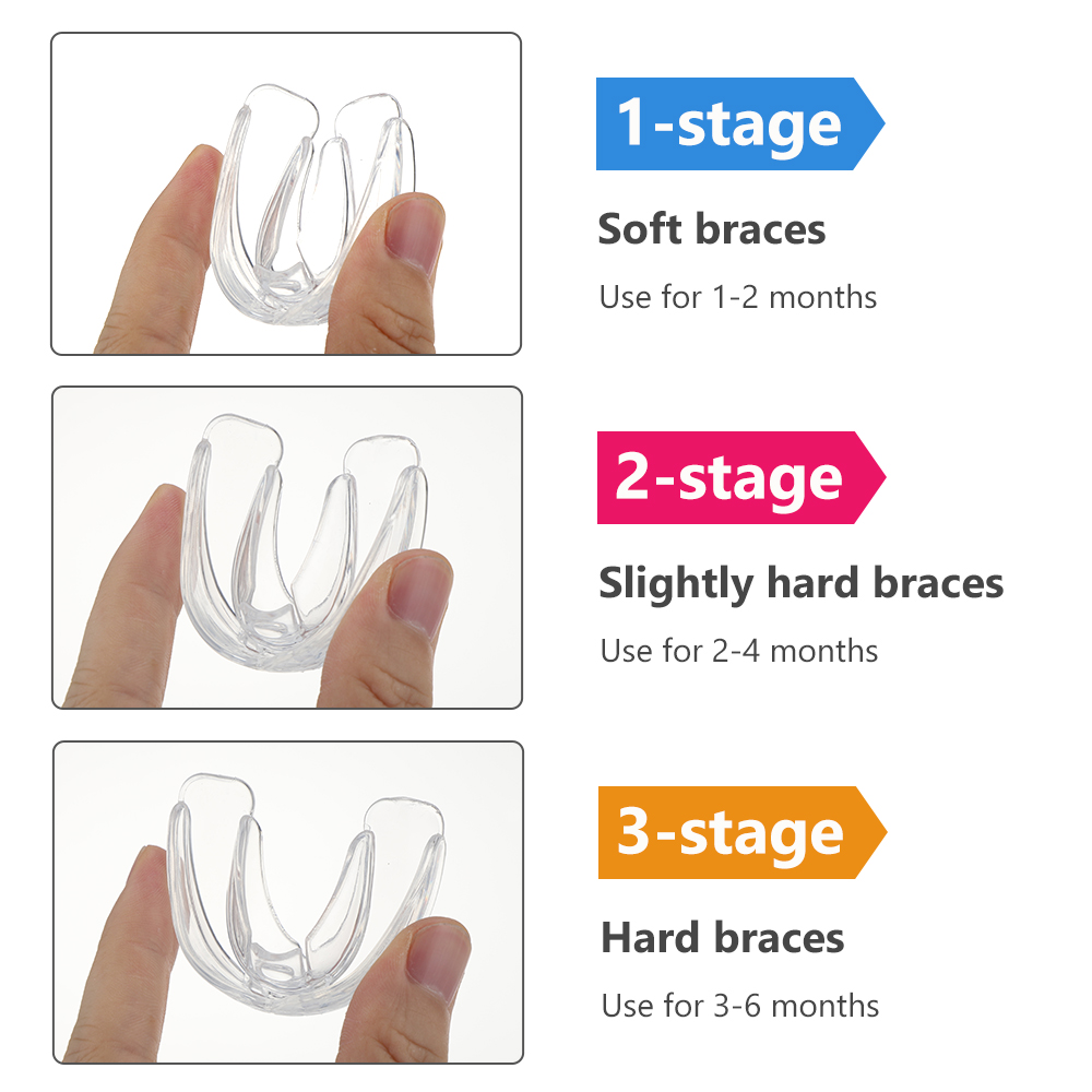 Set di apparecchi ortodontici  - Teeth Whitening Mouth Guard recensione e prezzo