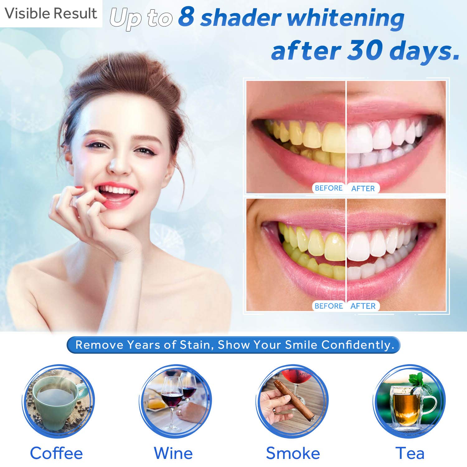 Gel sbiancante per denti Ricar - Teeth Whitening Levels recensione e prezzo