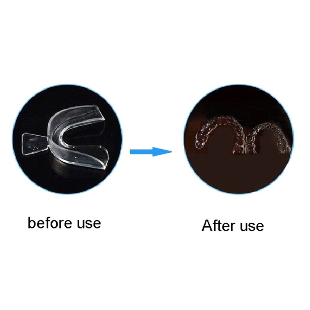 Set di 2/4 Pezzi di Apparecchi - Teeth Whitening Mouth Guard recensione e prezzo