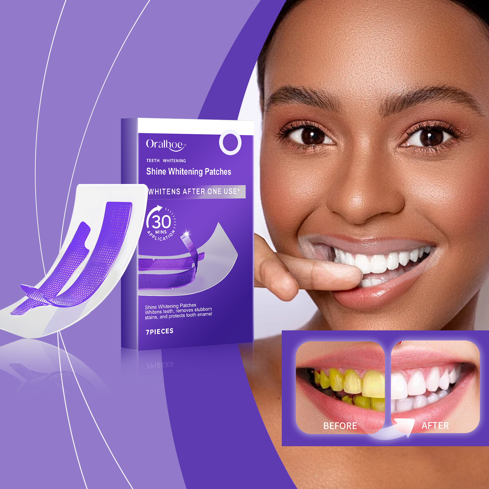 Strisce sbiancanti per denti v - Teeth Whitening At Home recensione e prezzo