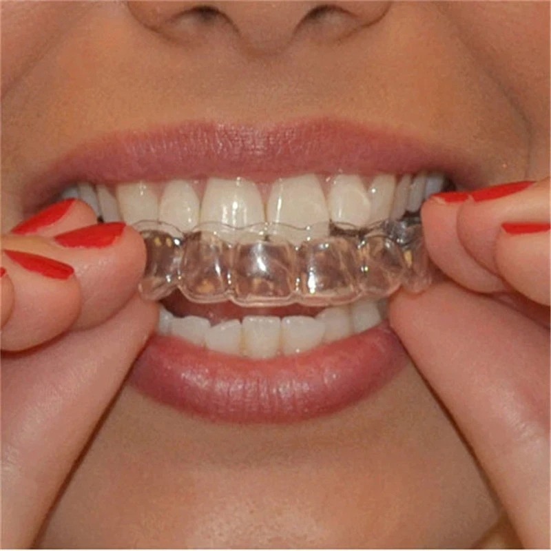 Anti Russare Bruxismo Dormire  - Teeth Whitening Mouth Guard recensione e prezzo