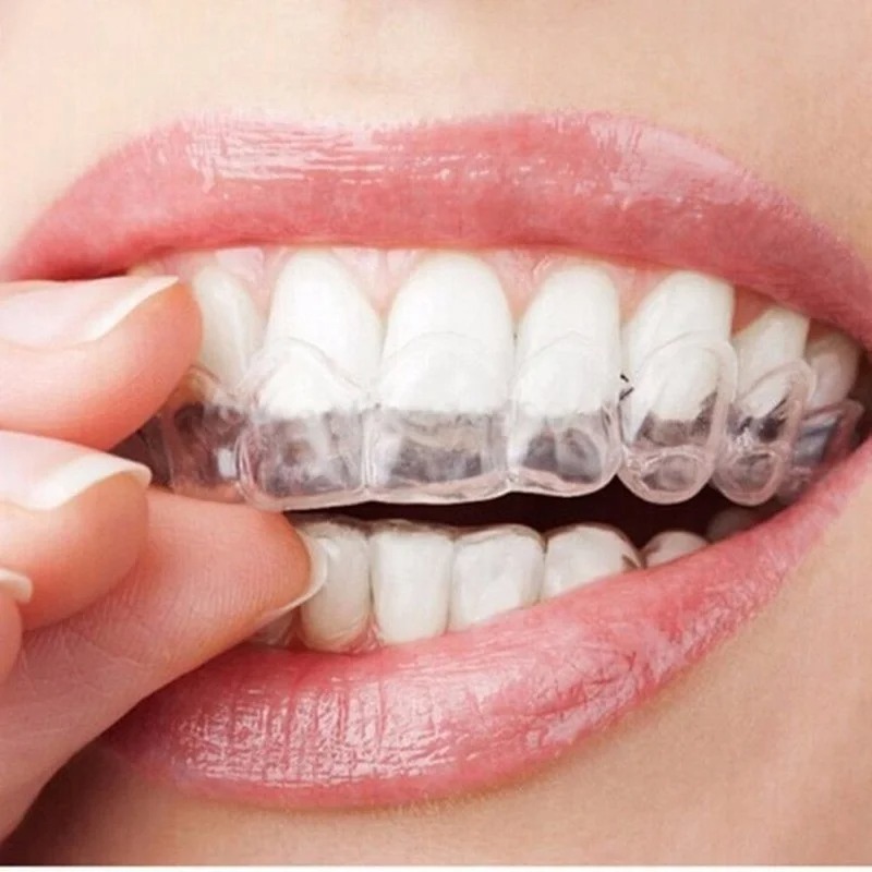 Anti Russare Bruxismo Dormire  - Teeth Whitening Mouth Guard recensione e prezzo
