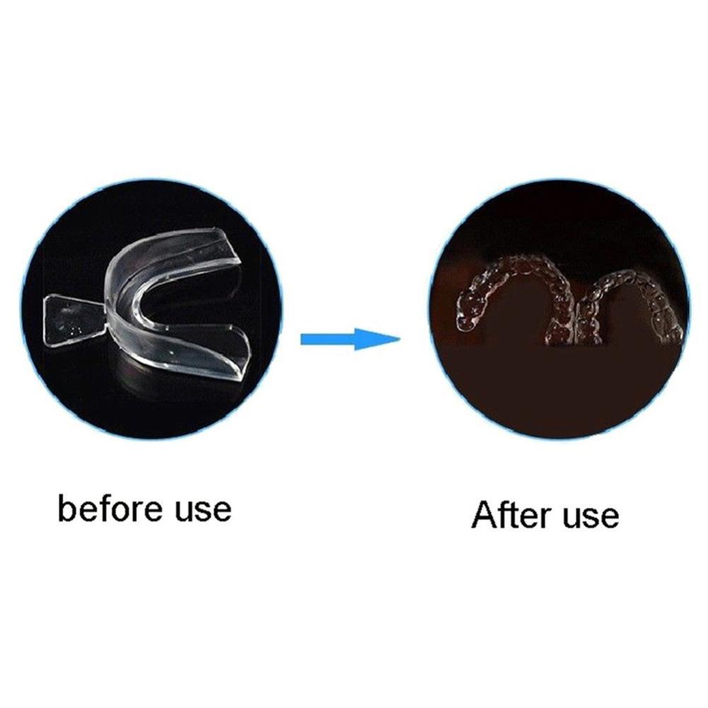 Paradenti in silicone per orto - Teeth Whitening Mouth Guard recensione e prezzo