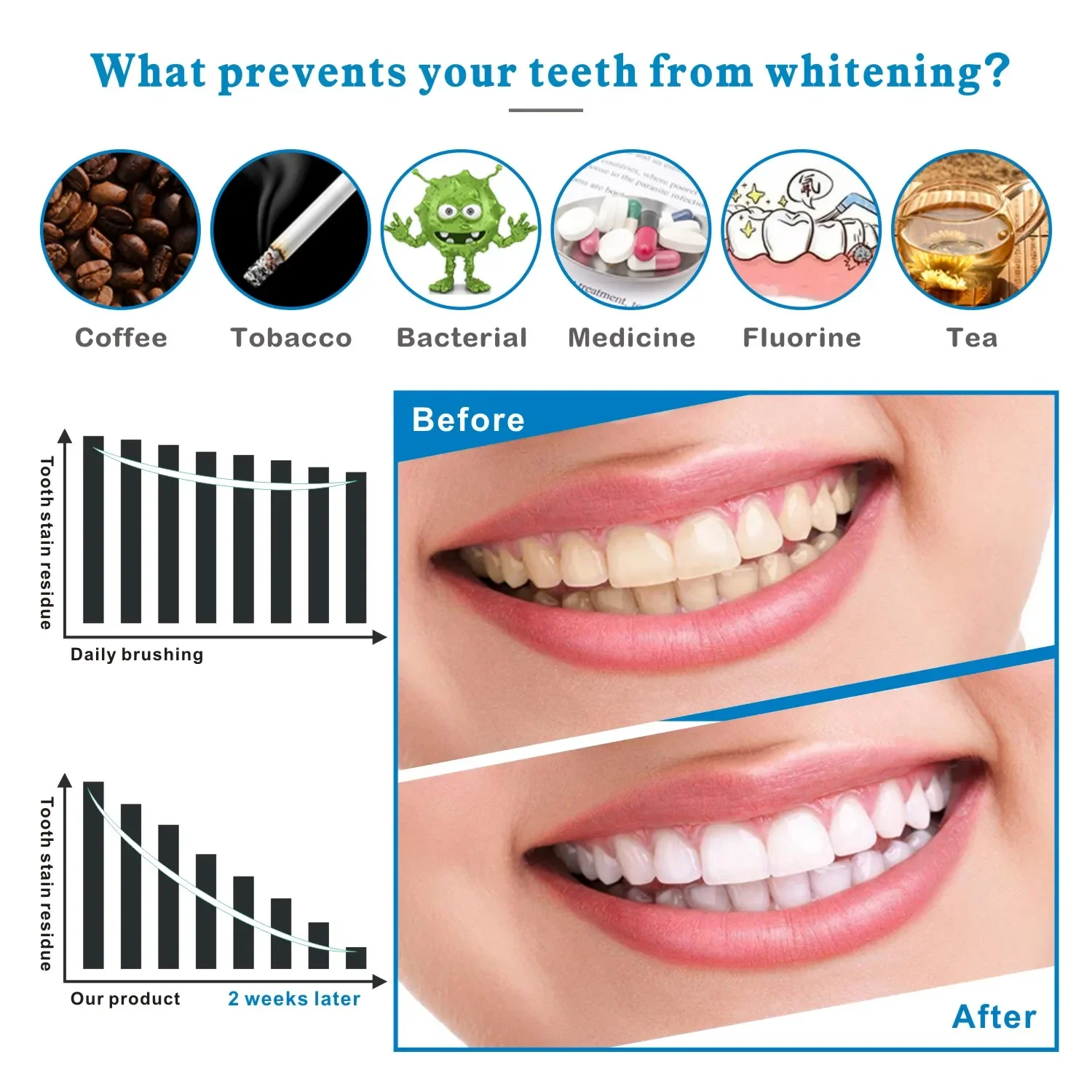 14/28pcs 3D Strisce Sbiancanti - Teeth Whitening Effects recensione e prezzo