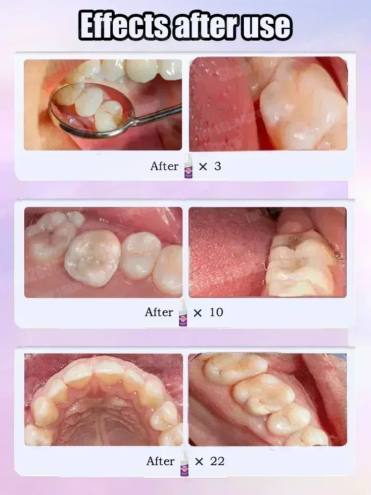 Vendite calde Le più vendute,  - Teeth Whitening Toothpaste recensione e prezzo