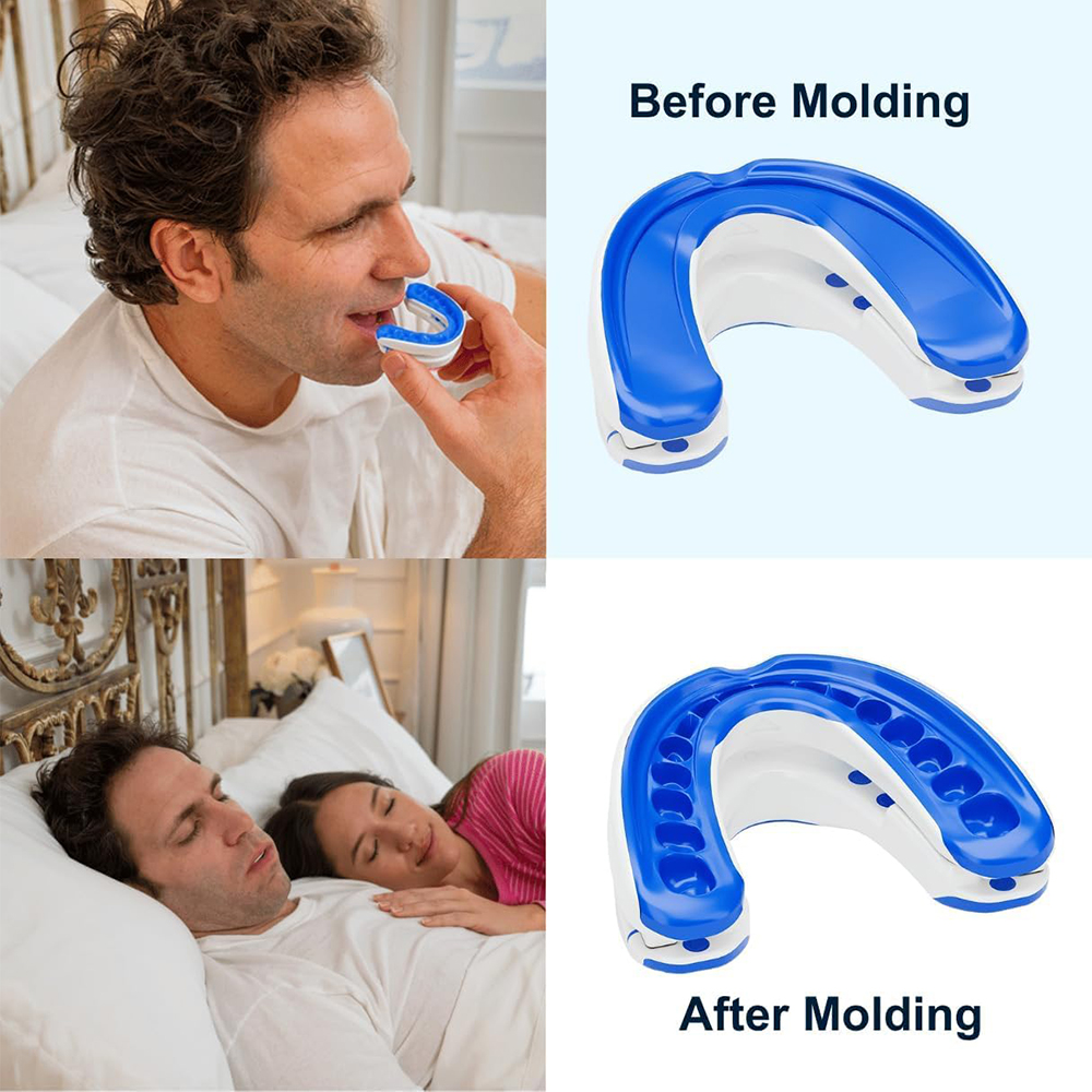 Bocchino antirussamento Dispos - Teeth Whitening Mouth Guard recensione e prezzo